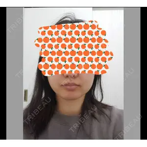 TCB東京中央美容外科 TCB東京中央美容外科 自由が丘院口コミ