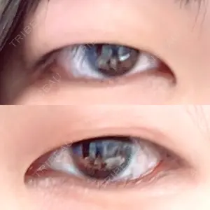 口コミ