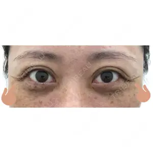 TCB東京中央美容外科 TCB東京中央美容外科 新宿三丁目院口コミ