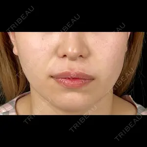 藤・ナチュレ美容クリニック 藤・ナチュレ美容クリニック 恵比寿院口コミ