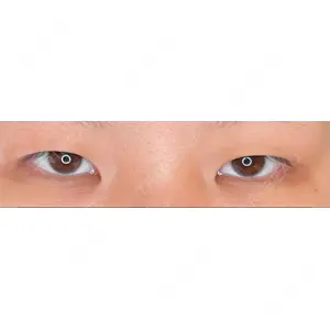 藤・ナチュレ美容クリニック 藤・ナチュレ美容クリニック 恵比寿院口コミ