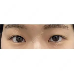 湘南美容クリニック 湘南美容クリニック 上野院口コミ