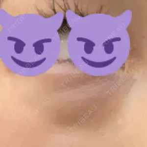 お茶の水美容形成クリニック 吉井クリニック口コミ