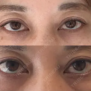 X CLINIC X CLINIC 銀座院口コミ