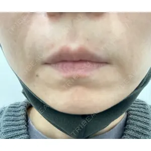 TCB東京中央美容外科 TCB東京中央美容外科 高田馬場院口コミ