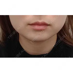 TCB東京中央美容外科 TCB東京中央美容外科 高田馬場院口コミ