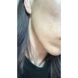 TCB東京中央美容外科 TCB東京中央美容外科 郡山院口コミ