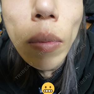 TCB東京中央美容外科 TCB東京中央美容外科 郡山院口コミ