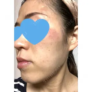 TCB東京中央美容外科 熊本院の