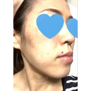 TCB東京中央美容外科 熊本院の