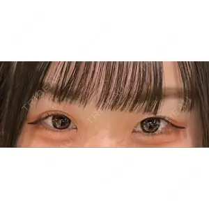 グローバルビューティークリニック 東京院の