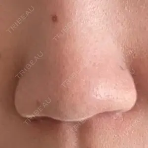 GLANZ CLINIC口コミ