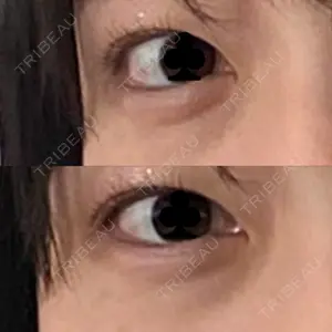 お茶の水美容形成クリニック 吉井クリニック口コミ