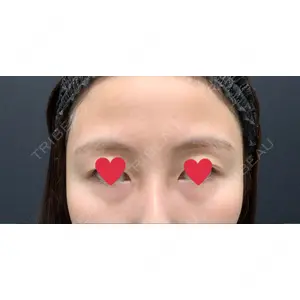 X CLINIC X CLINIC 銀座院口コミ