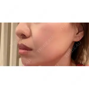 TCB東京中央美容外科 TCB東京中央美容外科 静岡院口コミ