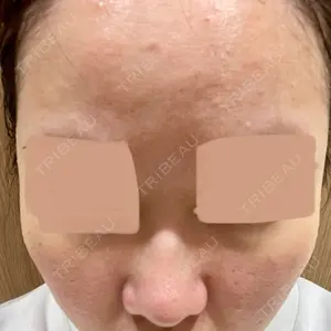 NOVUSBeautyClinic 新宿ラウンジ口コミ