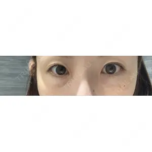 X CLINIC X CLINIC 銀座院口コミ