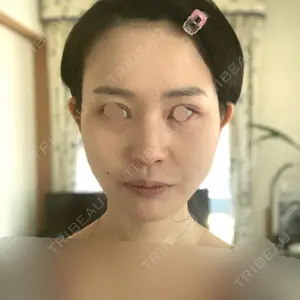 口コミ