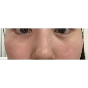 X CLINIC X CLINIC 銀座院口コミ