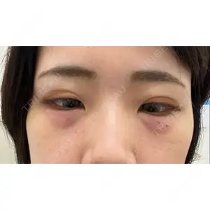 TCB東京中央美容外科 TCB東京中央美容外科 天王寺院口コミ