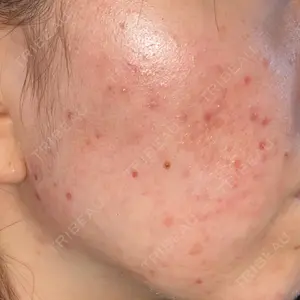KOBE CLINIC KOBE美容皮膚科 神戸東灘院口コミ