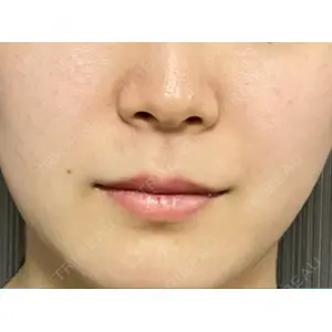L‘amour clinic Tokyo【ラムールクリニック東京】口コミ