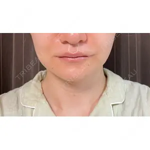 X CLINIC X CLINIC 銀座院口コミ