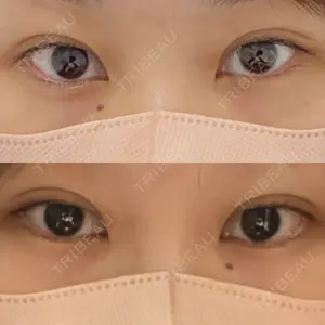 BELINDA CLINIC（ベリンダクリニック）新宿院の
