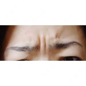 湘南美容クリニック 湘南美容クリニック 宇都宮院口コミ