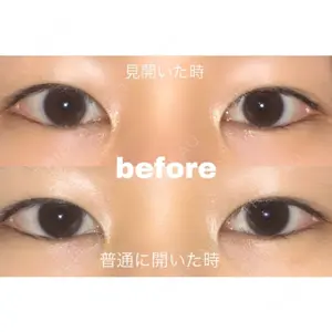 口コミ
