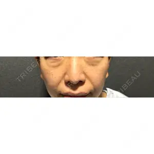 X CLINIC X CLINIC 銀座院口コミ