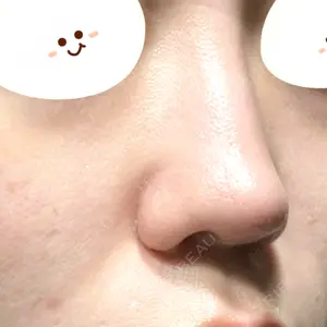 口コミ