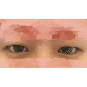 東京イセアクリニック口コミ