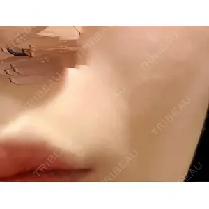 L‘amour clinic Tokyo【ラムールクリニック東京】口コミ
