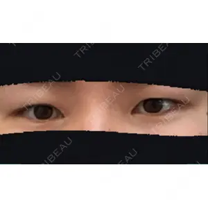 口コミ