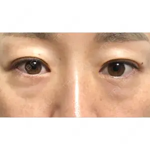 X CLINIC X CLINIC 銀座院口コミ
