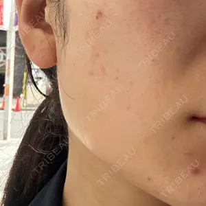 プラチナクリニック口コミ