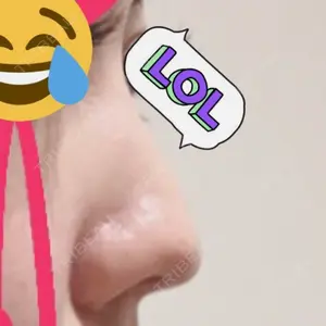 ラミチェ美容整形外科口コミ
