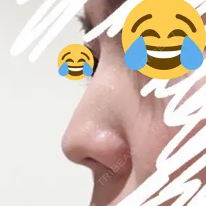 ラミチェ美容整形外科口コミ