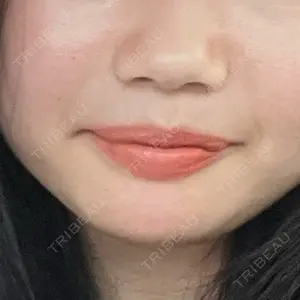 フィラークリニック フィラークリニック 町田院口コミ