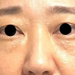 X CLINIC X CLINIC 銀座院口コミ