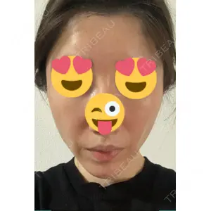 プラチナクリニック口コミ