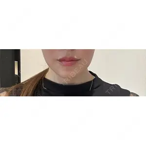 Nebula Clinic ネビュラクリニック 広島院口コミ