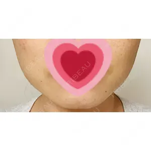 TCB東京中央美容外科 TCB東京中央美容外科 仙台駅前院口コミ