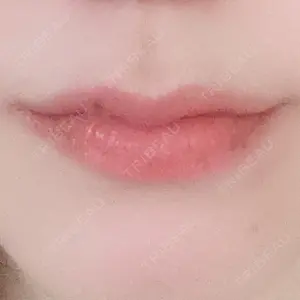 口コミ