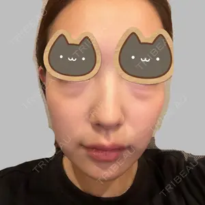 X CLINIC X CLINIC 銀座院口コミ