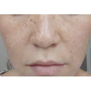 Tケアクリニック浜松町口コミ