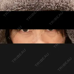 東京イセアクリニック口コミ