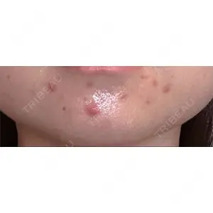 KMクリニック KM新宿クリニック口コミ