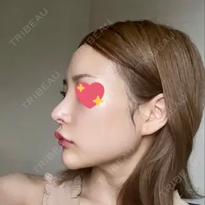 APスキンクリニック銀座口コミ